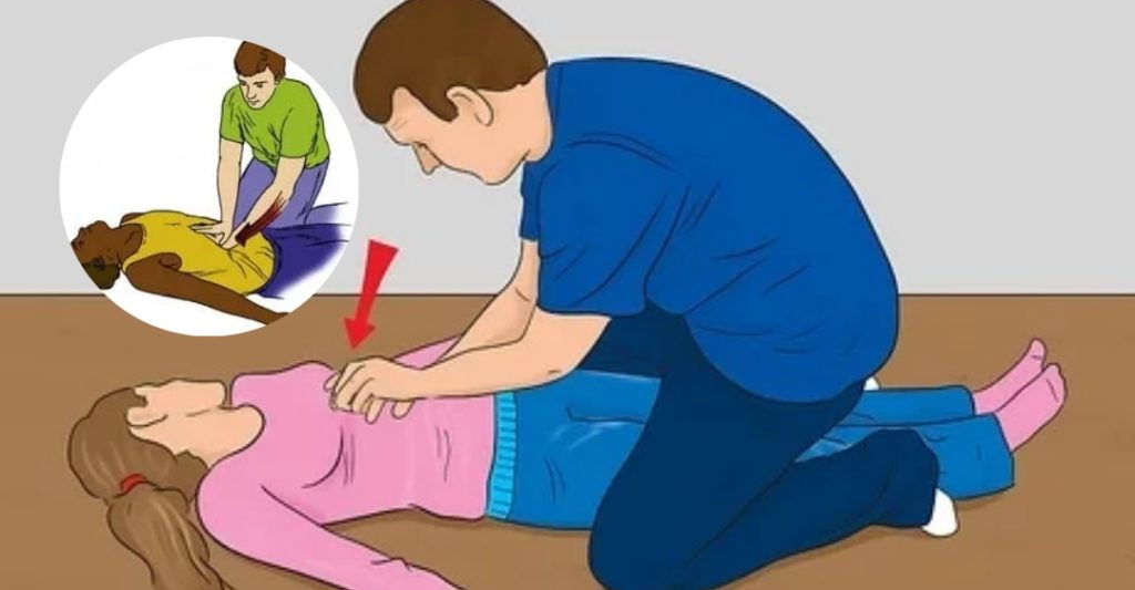 Heimlich Tư Thế Nằm